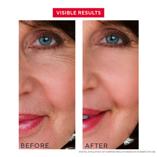 Before and after results using Mirabella Multi-Peptide Serum, showing improved skin hydration, reduced wrinkles, and enhanced elasticity.